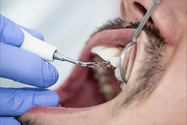 Pielęgnacja implantów